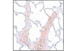 Immunohistochemistry of REEP2 in rat lung tissue with this product at 5 μg/ml.