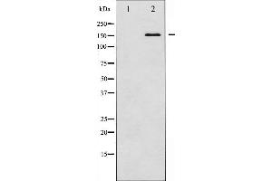 Western blot analysis of Bcr expression in K562 whole cell lysates,The lane on the left is treated with the antigen-specific peptide. (BCR antibody  (N-Term))