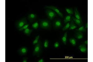 Image no. 1 for anti-Cofilin 1 (CFL1) (AA 1-167) antibody (ABIN598606) (Cofilin antibody  (AA 1-167))