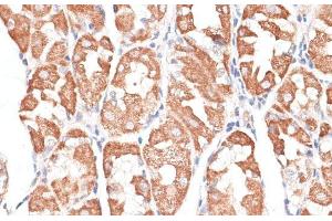 Immunohistochemistry of paraffin-embedded Human stomach using KIF4A Polyclonal Antibody at dilution of 1:100 (40x lens). (KIF4A antibody)