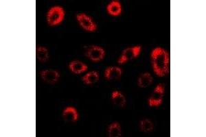 Immunofluorescent analysis of GILZ staining in U2OS cells. (TSC22D3 antibody)