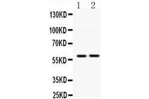 Observed bind size: 60KD (DGAT1 antibody  (Middle Region))