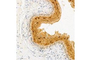 Immunohistochemistry of paraffin embedded mouse esophagus using SPRR3 (ABIN7075637) at dilution of 1:2000 (300x lens) (SPRR3 antibody)