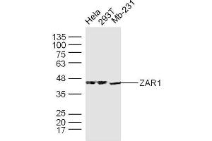 Human Hela, 293T, and Mb-231 cells probed with ZAR1 Polyclonal Antibody, unconjugated  at 1:300 overnight at 4°C followed by a conjugated secondary antibody at 1:10000 for 90 minutes at 37°C.