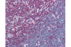 Immunohistochemical staining (Formalin-fixed paraffin-embedded sections) of human thymus with LCP2 monoclonal antibody, clone SLP-76/03  at 10 ug/mL working concentration. (LCP2 antibody  (AA 216-434))