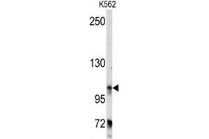 Western Blotting (WB) image for anti-Bicaudal D Homolog 2 (BICD2) antibody (ABIN3003477) (BICD2 antibody)