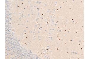 Immunohistochemistry (IHC) image for anti-Checkpoint Kinase 1 (CHEK1) (pSer317) antibody (ABIN6255201)
