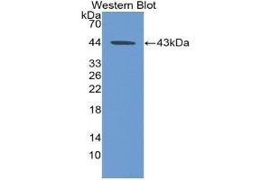 WB of Protein Standard: different control antibodies against Highly purified E.
