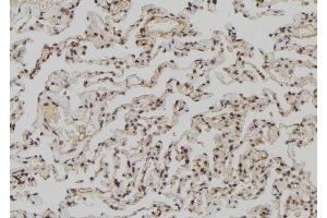 ABIN6273027 at 1/100 staining Human lung tissue by IHC-P. (ZCCHC11 antibody  (Internal Region))