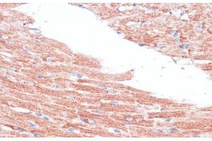 Immunohistochemistry of paraffin-embedded Mouse heart using FZD4 Polyclonal Antibody at dilution of 1:100 (40x lens). (FZD4 antibody)
