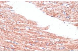 Immunohistochemistry of paraffin-embedded Mouse heart using FZD4 Polyclonal Antibody at dilution of 1:100 (40x lens).