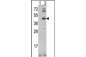 Western blot analysis of MVD (arrow) using rabbit polyclonal MVD Antibody (N-term) (ABIN390673 and ABIN2840969). (MVD antibody  (N-Term))