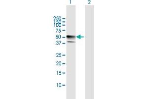 Western Blot analysis of B4GALT3 expression in transfected 293T cell line by B4GALT3 MaxPab polyclonal antibody. (B4GALT3 antibody  (AA 1-393))