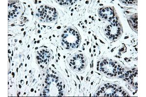 Immunohistochemical staining of paraffin-embedded breast tissue using anti-IRF3 mouse monoclonal antibody. (IRF3 antibody)