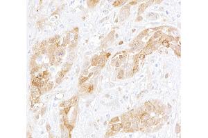 Immunohistochemistry (IHC) image for anti-Aryl Hydrocarbon Receptor (AHR) (AA 798-848) antibody (ABIN7453955) (Recombinant Aryl Hydrocarbon Receptor antibody  (AA 798-848))