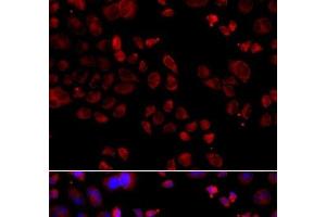 Immunofluorescence analysis of A549 cells using SLC22A11 Polyclonal Antibody
