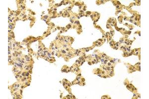 Immunohistochemistry of paraffin-embedded rat lung using PPP4C antibody. (PPP4C antibody  (AA 1-307))