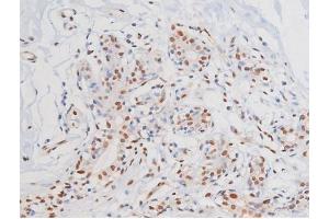 ABIN6267364 at 1/200 staining Human heart tissue sections by IHC-P. (KIT antibody  (pTyr703))