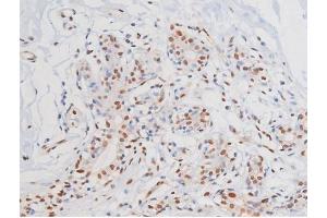 ABIN6267364 at 1/200 staining Human heart tissue sections by IHC-P.