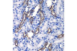 Immunohistochemistry of paraffin-embedded rat kidney using MATK antibody  at dilution of 1:100 (40x lens). (MATK antibody  (AA 352-466))