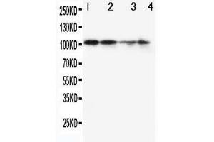 Anti-MCM2 antibody, Western blotting Lane 1: SW620 Cell Lysate Lane 2: PANC Cell Lysate Lane 3: JURKAT Cell Lysate Lane 4: HELA Cell Lysate