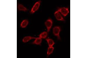 ABIN6266979 staining HeLa by IF/ICC. (GK2 antibody  (Internal Region))