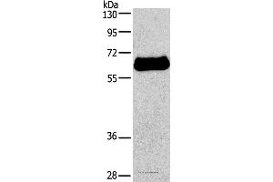 Western blot analysis of HepG2 cell, using IL2RB Polyclonal Antibody at dilution of 1:650 (IL2 Receptor beta antibody)