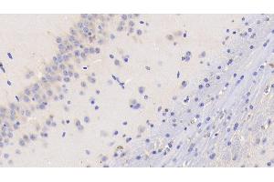 Detection of TF in Mouse Cerebellum Tissue using Monoclonal Antibody to Tissue Factor (TF) (Tissue factor antibody  (AA 30-251))