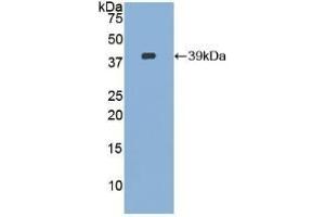 Detection of Recombinant CVL, Human using Polyclonal Antibody to Ezrin (EZR) (Ezrin antibody  (AA 1-295))