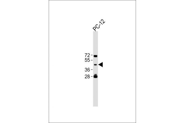 TBC1D13 anticorps  (AA 76-105)