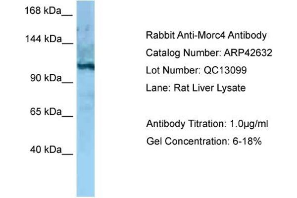MORC4 anticorps  (C-Term)