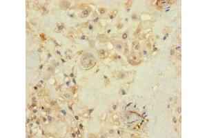 Immunohistochemistry of paraffin-embedded human placenta tissue using ABIN7142685 at dilution of 1:100 (PRKRIR antibody  (AA 612-761))