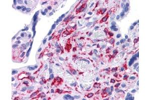 Stat5b antibody was used for immunohistochemistry at a concentration of 4-8 ug/ml. (STAT5B antibody  (C-Term))