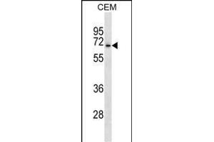 ACCN3 Antibody (N-term) (ABIN1539468 and ABIN2838152) western blot analysis in CEM cell line lysates (35 μg/lane). (ASIC3 antibody  (N-Term))