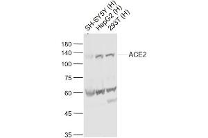 Lane 1: SH-SY5Y cell lysates; Lane 2: HepG2 cell lysates; Lane 3: 293T cell lysates probed with ACE2 Polyclonal Antibody, Unconjugated (bs-23444R) at 1:1000 dilution and 4˚C overnight incubation. (ACE2 antibody  (AA 351-450))