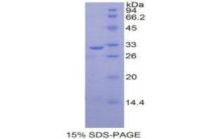 SDS-PAGE (SDS) image for NADPH Oxidase 1 (NOX1) (AA 235-488) protein (His tag) (ABIN2121762) (NOX1 Protein (AA 235-488) (His tag))