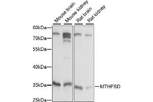 Western blot analysis of extracts of various cell lines, using MTHFSD antibody (ABIN7268486) at 1:1000 dilution. (MTHFSD antibody  (AA 1-383))