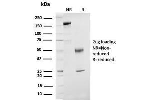SDS-PAGE Analysis Purified ER-beta Mouse Monoclonal Antibody (ESR2/3207).