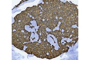 IHC analysis of GLB1/Beta-galactosidase using anti-GLB1/Beta-galactosidase antibody (ABIN7601806).