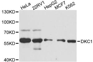 Western blot analysis of extracts of various cell lines, using DKC1 antibody. (DKC1 antibody)