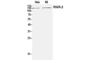 Western Blot analysis of Hela, KB cells using PDGFRB Polyclonal Antibody at dilution of 1:1000. (PDGFRB antibody)