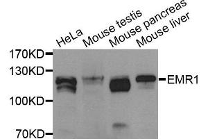 Western blot analysis of Jurkat cell lysate using EMR1 antibody. (F4/80 antibody  (AA 21-290))