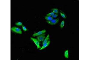 Immunofluorescent analysis of HepG2 cells using ABIN7153497 at dilution of 1:100 and Alexa Fluor 488-congugated AffiniPure Goat Anti-Rabbit IgG(H+L) (GABRB3 antibody  (AA 328-450))