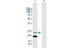 Western Blotting (WB) image for anti-Immunoglobulin lambda-Like Polypeptide 1 (IGLL1) (AA 1-213) antibody (ABIN516975)