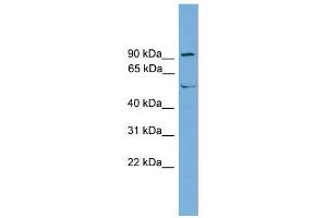 TEC antibody used at 1 ug/ml to detect target protein. (NR4A3 antibody  (Middle Region))