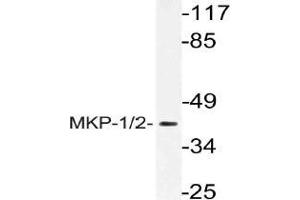 Western blot (WB) analysis of MKP-1/2 antibody in extracts from Jurkat cells.