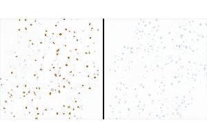 Immunocytochemistry (ICC) image for anti-Tripartite Motif Containing 28 (TRIM28) (pSer824) antibody (ABIN7454038)