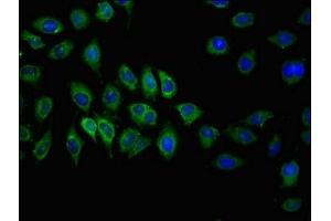 Immunofluorescent analysis of A549 cells using ABIN7146636 at dilution of 1:100 and Alexa Fluor 488-congugated AffiniPure Goat Anti-Rabbit IgG(H+L) (ABCC2 antibody  (AA 724-947))