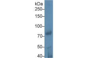 Western Blot; Sample: Rat Testis lysate; Primary Ab: 1µg/ml Rabbit Anti-Mouse iPLA2 Antibody Second Ab: 0. (PLA2G6 antibody  (AA 481-702))