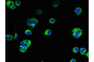 Immunofluorescent analysis of MCF-7 cells using ABIN7173155 at dilution of 1:100 and Alexa Fluor 488-congugated AffiniPure Goat Anti-Rabbit IgG(H+L) (TMEM222 antibody  (AA 77-164))